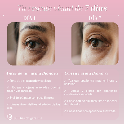 Bionova Retinol Eye Stick — Eliminates Dark Circles, Bags, and Fine Lines