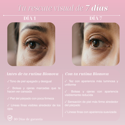 Bionova Retinol Eye Stick — Eliminates Dark Circles, Bags, and Fine Lines