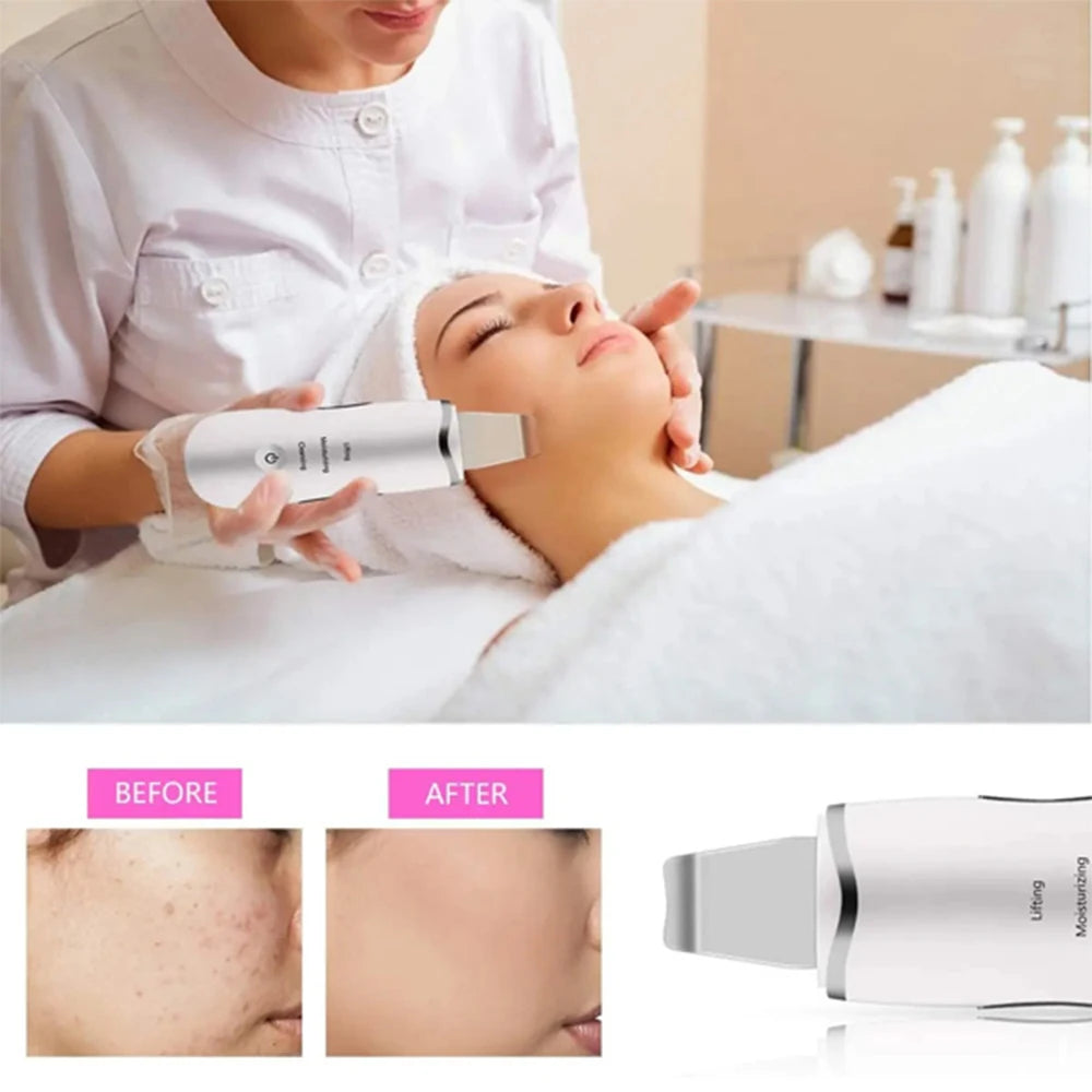 Ultrasonic Skin Scrubber 3-in-1 — Deep Cleanse, Exfoliate & Glow