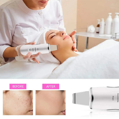 Ultrasonic Skin Scrubber 3-in-1 — Deep Cleanse, Exfoliate & Glow