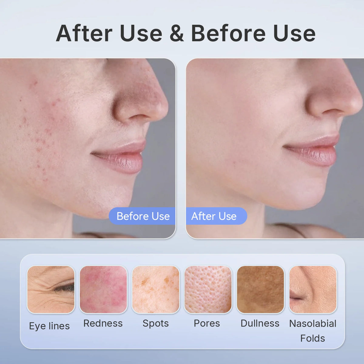 LED Red Light Therapy Face Mask — 4-Wavelength Anti-Aging & Skin Rejuvenation
